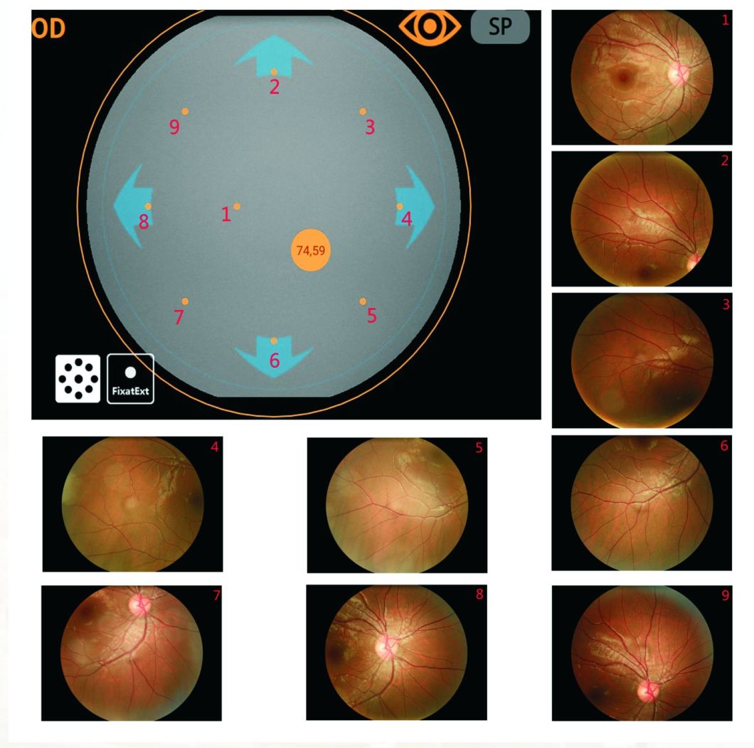Reticam 3100 China Top Quality Ophthalmic Equipment Auto Fundus Camera
