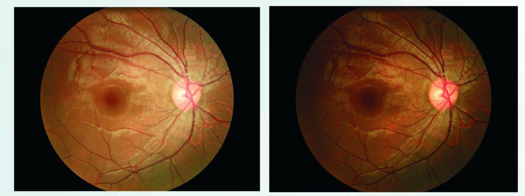 Reticam 3100 China Top Quality Ophthalmic Equipment Auto Fundus Camera