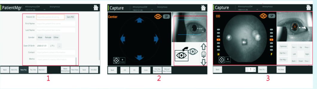 Reticam 3100 China Top Quality Ophthalmic Equipment Auto Fundus Camera