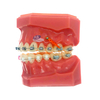 Orthodontic Dental Model