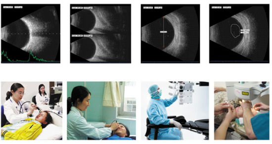 Ophthlamic Equipment, China Ophthalmic Ab Scan