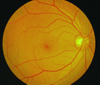 APS-B China Ophthalmic Equipment Non-Mydriatic Fundus Camera with Fluorescein Angiography Function