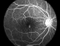 Cámara retinal de calidad superior del equipo oftálmico de China China