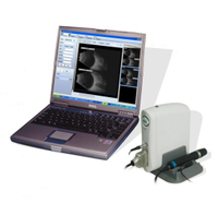SW2100 Ophthalmic Ab Scan,