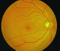 APS-A Cámara de retina para equipos oftalmológicos de alta calidad en China