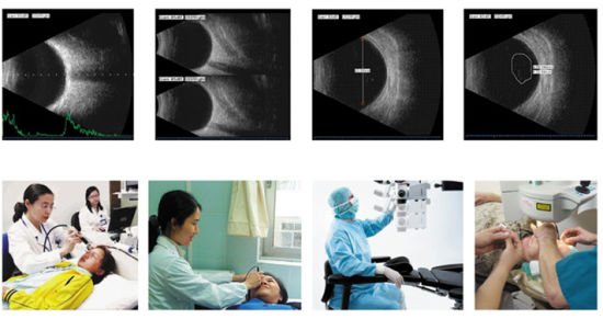 Matériel ophtalmique, Ab scan ophtalmique de Chine