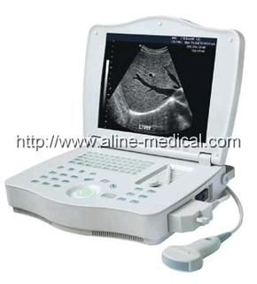 Portable Ultrasound System
