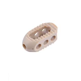 Jaula lumbar posterior de la fusión de Interbody (arqueada)