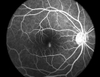 APS-B China Ophthalmic Equipment Non-Mydriatic Fundus Camera with Fluorescein Angiography Function