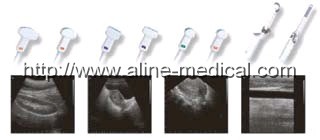 high-end digital ultrasound imaging system
