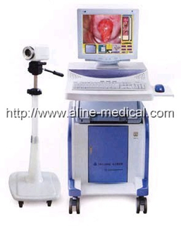 Electronic Colposcope