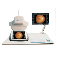 RET- 3100 Китай высококачественное офтальмологическое оборудование Автоматическая камера глазного дна Функция FFA