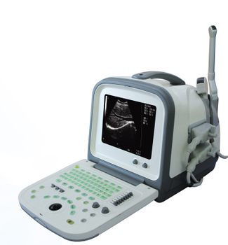 B-Ultrasound Scanner Machine (Model HY5511)