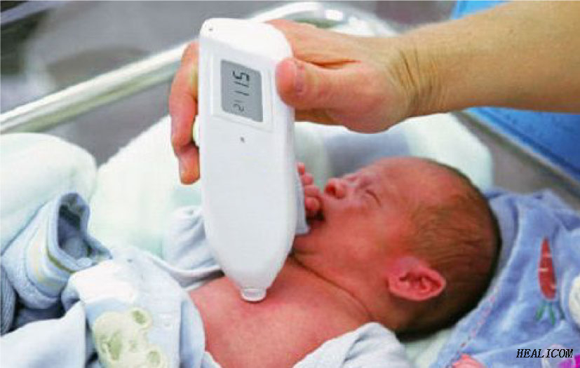 Cheaper Price MBJ20 Neonatal Transcutaneous bilirubin jaundice Meter