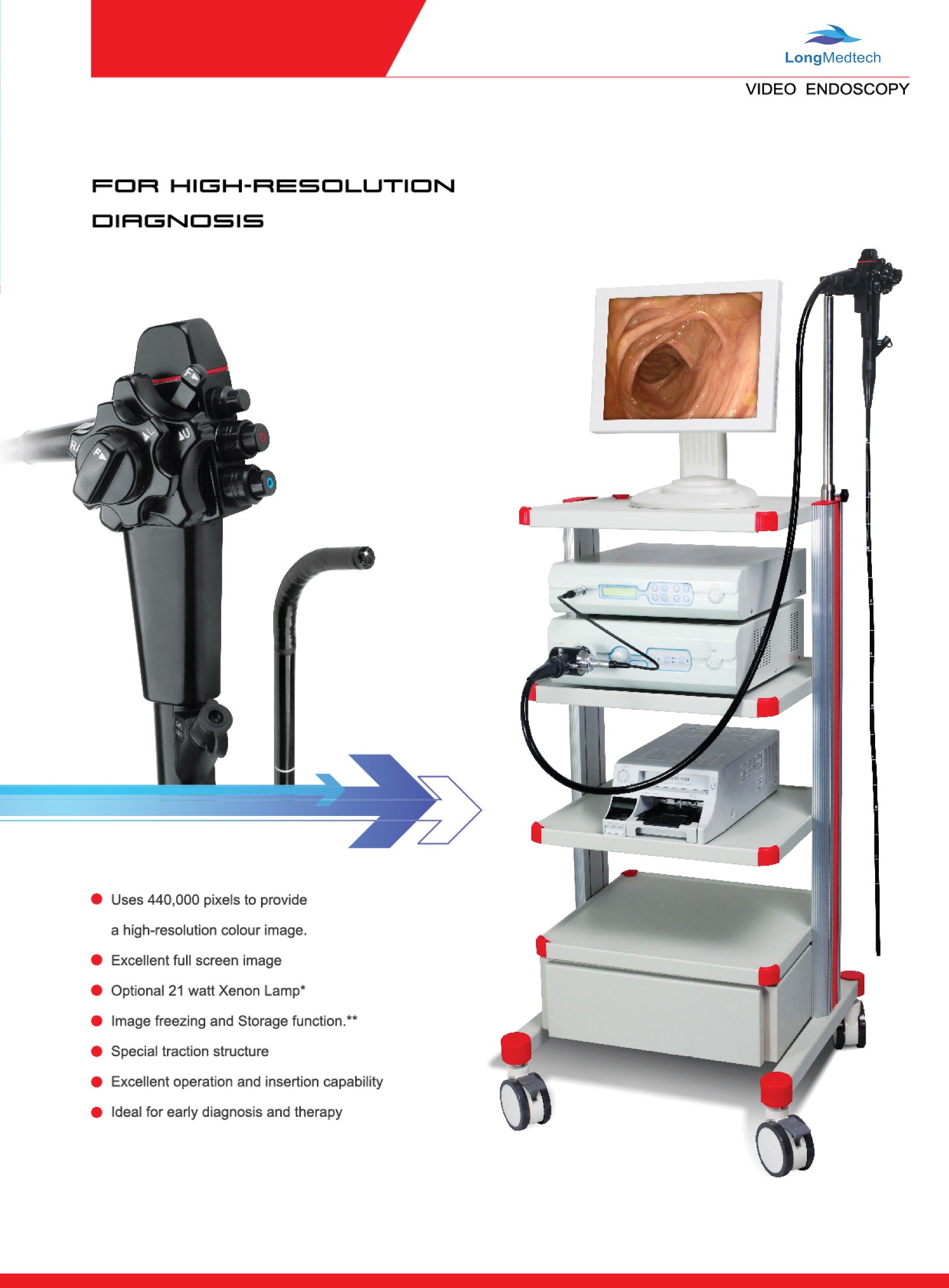Vid&eacute;o-endoscopie-1